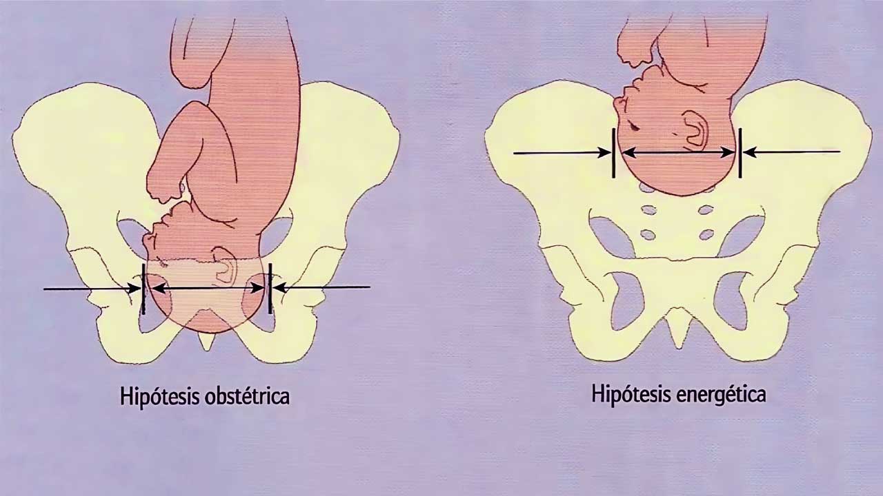 doğum ikilemi